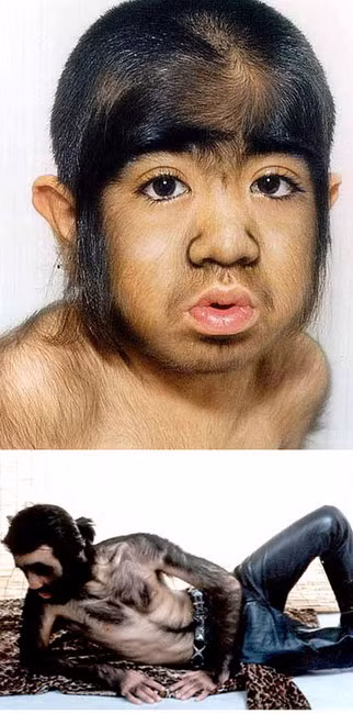 Yu Zhenhuan, người Trung Quốc, có rất nhiều lông trên mặt và cơ thể, điều này không chỉ gây khó chịu mà còn khiến cậu gặp khó khăn trong việc lắng nghe do lông trong tai mọc quá nhiều. Yu được sinh ra ở thành phố An Sơn, Trung Quốc, vào năm 1979. Cậu ta bắt đầu phát triển lông khi mới 2 tuổi, dần dần cuối cùng lông đã bao phủ khoảng 96% cơ thể cậu. Cậu bé “lông lá” người Trung Quốc là một ca sĩ nhạc rock đầy tham vọng và cậu đã sử dụng vẻ khác thường của mình để bắt đầu sự nghiệp âm nhạc của mình. Xem thêm: Phát hoảng với những thân hình "khủng" nhất thế giới do ăn nhiều / Những hình ảnh thương tâm về căn bệnh 'lạ' ở Quảng Ngãi