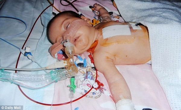 Sau ca phẫu thuật tim mạch, gia đình Rosanna đã cho bé Rosanna Ogden đi học bơi để mau bình phục. Xem thêm: Những loại cá cực tốt cho sức khỏe (P2) / Cá quả: Những công dụng tuyệt vời có thể bạn chưa biết Sau ca phẫu thuật tim mạch, gia đình Rosanna đã cho bé Rosanna Ogden đi học bơi để mau bình phục. Xem thêm: Những loại cá cực tốt cho sức khỏe (P2) / Cá quả: Những công dụng tuyệt vời có thể bạn chưa biết