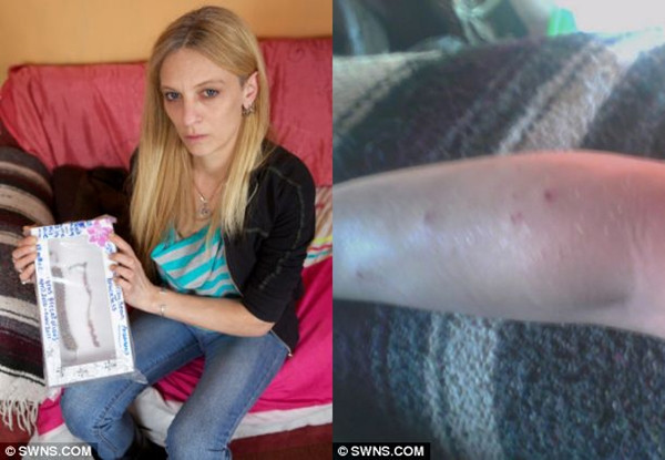 Cô Jo Wollacott đã liên tục bị những căn bệnh xui xẻo từ tháng 4 năm 2010.