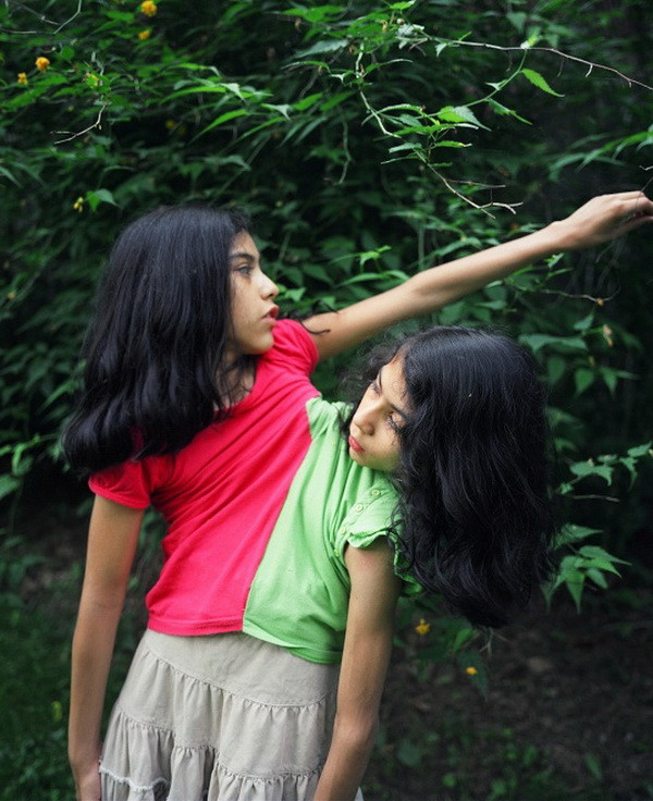 Bên cạnh đó, mẹ của cặp đôi này phải may những bộ quần áo đặc biệt để họ có thể mặc chung. Việc mặc quần áo cho cả hai cũng không hề dễ dàng. Xem thêm: Những hình ảnh thương tâm về căn bệnh 'lạ' ở Quảng Ngãi / Điểm danh một số người mắc hội chứng kỳ lạ "người sói" Bên cạnh đó, mẹ của cặp đôi này phải may những bộ quần áo đặc biệt để họ có thể mặc chung. Việc mặc quần áo cho cả hai cũng không hề dễ dàng. Xem thêm: Những hình ảnh thương tâm về căn bệnh 'lạ' ở Quảng Ngãi / Điểm danh một số người mắc hội chứng kỳ lạ "người sói"