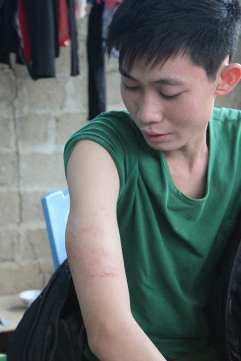 Theo "thầy" Khang, thuốc có tác dụng khi phát độc ra ngoài da. Theo "thầy" Khang, thuốc có tác dụng khi phát độc ra ngoài da.