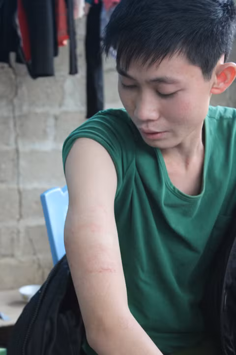 Theo "thầy" Khang, thuốc có tác dụng khi phát độc ra ngoài da.