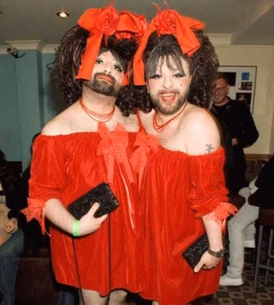 Các ca song sinh dính liền kiểu này không nhiều và khả năng sống sót rất thấp. Mặc dù vậy, trên thế giới đâu đó vẫn có phép màu khiến những con người thiếu may mắn sống, hoạt động và vui chơi như người bình thường. Xem thêm: Những loại quả cực tốt giúp thanh nhiệt, giải độc cho mùa hè.