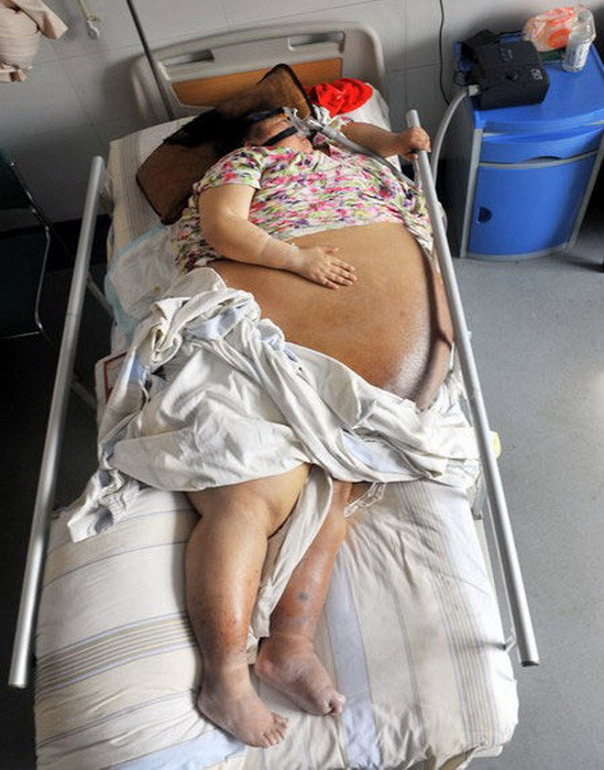 Trong khi đó, vòng bụng của cô vẫn tăng kích cỡ mỗi ngày. Trong khi đó, vòng bụng của cô vẫn tăng kích cỡ mỗi ngày.