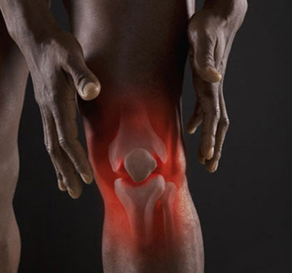 Những cơn đau khớp sẽ nhẹ đi nếu bạn có chế độ ăn uống phù hợp Những cơn đau khớp sẽ nhẹ đi nếu bạn có chế độ ăn uống phù hợp