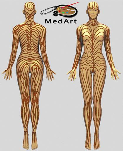 Đây là một loại bệnh cực kỳ hiếm do đột biến gen. Trên da người bệnh xuất hiện những viền sọc không hề nối với hệ thần kinh, cơ bắp hay huyết mạch. Những đường viền này có hình chữ “V” trên lưng và chữ “S” trên cổ, bụng và các phần cơ thể bên dưới khác. Đây là một loại bệnh cực kỳ hiếm do đột biến gen. Trên da người bệnh xuất hiện những viền sọc không hề nối với hệ thần kinh, cơ bắp hay huyết mạch. Những đường viền này có hình chữ “V” trên lưng và chữ “S” trên cổ, bụng và các phần cơ thể bên dưới khác.