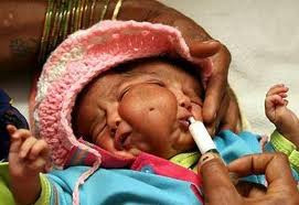 Sọ mặt trùng lặp: Tên khoa học là Diprosopus (đôi khi gọi là sọ mặt trùng lặp) là một rối loạn hiếm gặp trong đó khuôn mặt được nhân đôi. Điều này xảy ra khi có sự tham gia của hai thai nhi riêng biệt. Sọ mặt trùng lặp: Tên khoa học là Diprosopus (đôi khi gọi là sọ mặt trùng lặp) là một rối loạn hiếm gặp trong đó khuôn mặt được nhân đôi. Điều này xảy ra khi có sự tham gia của hai thai nhi riêng biệt.