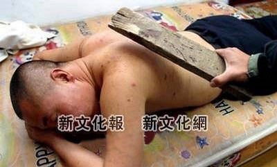 Bệnh thích ‘ngược đãi’: Đây là chứng bệnh vô cùng oái oăm khi triệu chứng là liên tục ‘thèm khát’ được người khác tiến hành các hành vi tra tấn thể xác. Hiện giới y khoa trên thế giới vẫn chưa giải thích được nguyên nhân gây bệnh cũng như cách phòng căn bệnh này. Bệnh thích ‘ngược đãi’: Đây là chứng bệnh vô cùng oái oăm khi triệu chứng là liên tục ‘thèm khát’ được người khác tiến hành các hành vi tra tấn thể xác. Hiện giới y khoa trên thế giới vẫn chưa giải thích được nguyên nhân gây bệnh cũng như cách phòng căn bệnh này.