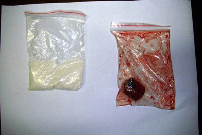 Máu bồ câu cũng là loại được sử dụng nhiều để giả trinh tiết cho gái bán dâm. Đối với dân trong nghề, vài giọt máu bồ câu là có thể đánh lừa bất kỳ khách làng chơi ham của mới nào. Máu bồ câu cũng là loại được sử dụng nhiều để giả trinh tiết cho gái bán dâm. Đối với dân trong nghề, vài giọt máu bồ câu là có thể đánh lừa bất kỳ khách làng chơi ham của mới nào.