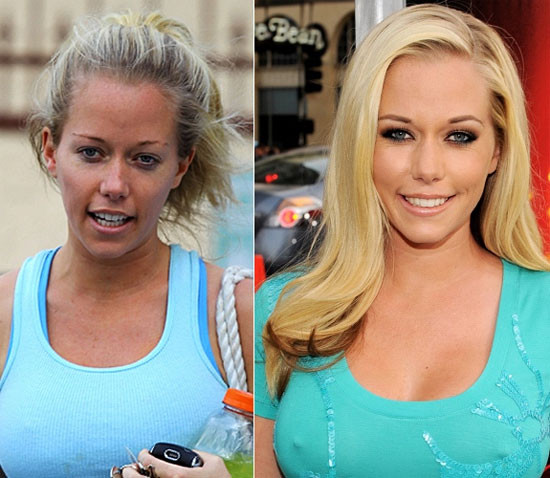 Kendra Wilkinson Xem thêm:Sao xưa và nay: Họ đã “lột xác” ra sao?