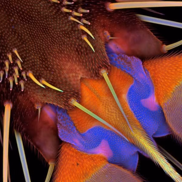 Chân thứ 3 của một con ruồi cái và phần bụng của nó trên kính hiển vi. Bức hình được Tiến sĩ Jan Michels, Viện Động vật học thuộc đại học Christian-Albrechts, Kiel, Đức cung cấp.