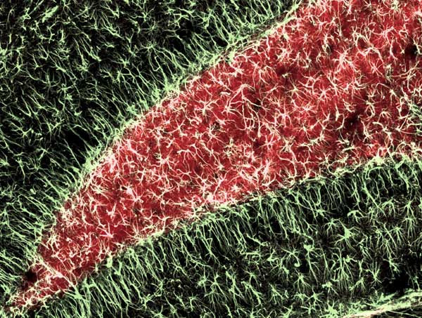 Ảnh chụp các tế bào bên trong não bộ của một con chuột trưởng thành. Đây là khu vực quyết định sự học tập và bộ nhớ của loài động vật này. Bức hình do Tiến sĩ Sandra Dieni, Viện Giải phẫu học và Sinh học tế bào, Đại học Albert-Ludwigs, Freiburg, Đức cung cấp.