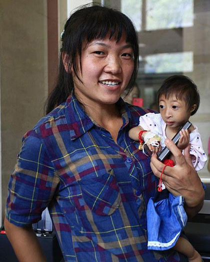 Các bác sỹ tại Hoài Hóa, Hồ Nam, Trung Quốc, tin rằng hiện tượng đột biến gen đã khiến cơ thể của Liang ngừng phát triển. Điều đó đồng nghĩa, cô bé sẽ mãi chỉ dừng lại ở chiều cao và cân nặng như hiện tại. Các bác sỹ tại Hoài Hóa, Hồ Nam, Trung Quốc, tin rằng hiện tượng đột biến gen đã khiến cơ thể của Liang ngừng phát triển. Điều đó đồng nghĩa, cô bé sẽ mãi chỉ dừng lại ở chiều cao và cân nặng như hiện tại.