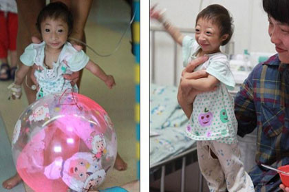 Khi nhóm phóng viên tới gặp cô bé, Liang vẫn mải miết chơi với quả bóng cùng những đứa trẻ khác. Dường như cô bé hạt tiêu không để ý chuyện gì đang xảy ra xung quanh. Khi nhóm phóng viên tới gặp cô bé, Liang vẫn mải miết chơi với quả bóng cùng những đứa trẻ khác. Dường như cô bé hạt tiêu không để ý chuyện gì đang xảy ra xung quanh.