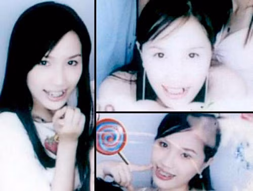 Khi chưa phẫu thuật, Bảo Thy sở hữu một bộ răng "ngô, đỗ" lẫn lộn.