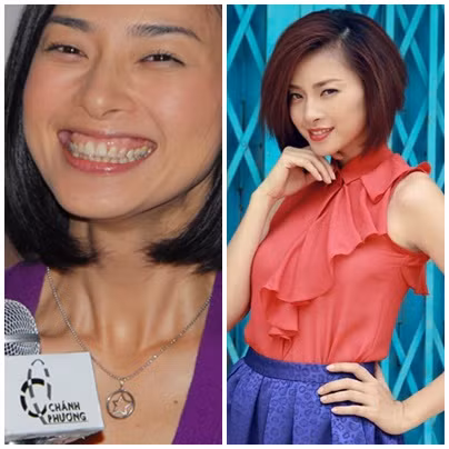 Hiện nay Ngô Thanh Vân đã có nhiều sự thay đổi không chỉ hàm răng mà ngay cả nụ cười.
