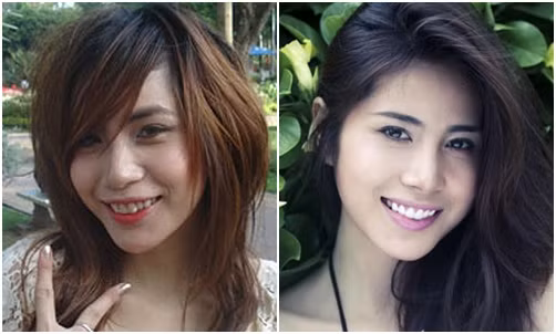 Giờ đây Thủy Tiên đã sở hữu hàm răng trắng và đều.