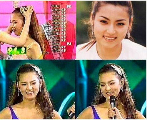 Park Shi Yeon được mệnh danh là "Hoa hậu dao kéo" bởi gương mặt của cô gần như khác hoàn toàn so với thời quá khứ. Xem thêm: Ngắm dàn Siêu Sao Hàn Quốc thanh tú, lịch lãm và phong cách Park Shi Yeon được mệnh danh là "Hoa hậu dao kéo" bởi gương mặt của cô gần như khác hoàn toàn so với thời quá khứ. Xem thêm: Ngắm dàn Siêu Sao Hàn Quốc thanh tú, lịch lãm và phong cách