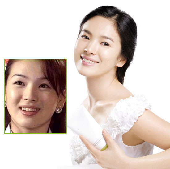 Song Hye Kyo trước khi đến nha sĩ cũng "khấp khểnh" như ai. Xem thêm:Môi xinh nồng nàn, quyến rũ như Sao Hàn trên tạp chí Song Hye Kyo trước khi đến nha sĩ cũng "khấp khểnh" như ai. Xem thêm:Môi xinh nồng nàn, quyến rũ như Sao Hàn trên tạp chí