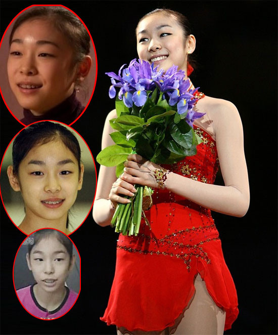 Kim Yuna đã phải đeo niềng răng để có được hàm răng đều tăm tắp và "sáng trưng" như vậy. Xem thêm:Môi xinh nồng nàn, quyến rũ như Sao Hàn trên tạp chí Kim Yuna đã phải đeo niềng răng để có được hàm răng đều tăm tắp và "sáng trưng" như vậy. Xem thêm:Môi xinh nồng nàn, quyến rũ như Sao Hàn trên tạp chí