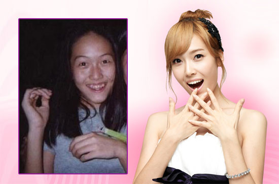 Jessica chắc phải cảm ơn nha sĩ đầu tiên, vì nhờ thế cô mới được cười thoải mái mà không phải ngại ngần. Xem thêm:Môi xinh nồng nàn, quyến rũ như Sao Hàn trên tạp chí Jessica chắc phải cảm ơn nha sĩ đầu tiên, vì nhờ thế cô mới được cười thoải mái mà không phải ngại ngần. Xem thêm:Môi xinh nồng nàn, quyến rũ như Sao Hàn trên tạp chí