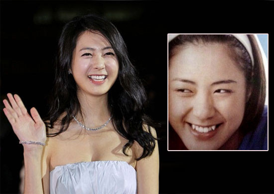 Lee Yo Won ngậm ngùi chia tay hai chiếc răng chuột. Xem thêm:Môi xinh nồng nàn, quyến rũ như Sao Hàn trên tạp chí Lee Yo Won ngậm ngùi chia tay hai chiếc răng chuột. Xem thêm:Môi xinh nồng nàn, quyến rũ như Sao Hàn trên tạp chí