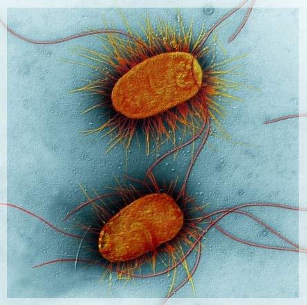 Các vi sinh vật này có thể tìm thấy trong các món cơm bảo quản không đúng quy cách, thịt chưa nấu chín, nước hoặc thực phẩm bị nhiễm vi sinh… Thời gian ủ bệnh trung bình từ 6 - 48 giờ, thường lâu hơn so với NĐTP do hóa chất. Triệu chứng lâm sàng chủ yếu là triệu chứng tiêu hóa: đau bụng, buồn nôn, nôn, tiêu chảy.