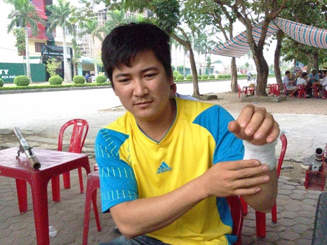 Anh Đặng Văn Chung cho biết, khi bỏ chạy nhóm người này đã xả súng vào ngôi nhà chị Hằng nên đạn lạc đã bắn trúng anh và nữ đồng nghiệp làm việc gần đó Anh Đặng Văn Chung cho biết, khi bỏ chạy nhóm người này đã xả súng vào ngôi nhà chị Hằng nên đạn lạc đã bắn trúng anh và nữ đồng nghiệp làm việc gần đó