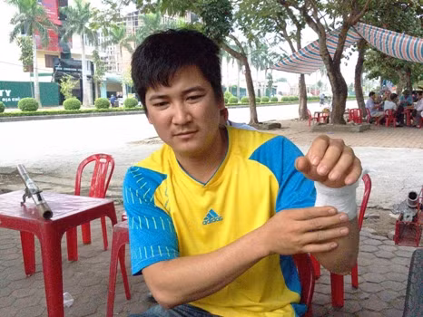 Anh Đặng Văn Chung cho biết, khi bỏ chạy nhóm người này đã xả súng vào ngôi nhà chị Hằng nên đạn lạc đã bắn trúng anh và nữ đồng nghiệp làm việc gần đó