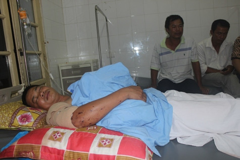 Sau hơn 3 ngày được đưa vào điều trị và phẫu thuật lấy mảnh vụn từ vụ nổ hiện sức khỏe của lái xe Ninh đang dần ổn định lại Sau hơn 3 ngày được đưa vào điều trị và phẫu thuật lấy mảnh vụn từ vụ nổ hiện sức khỏe của lái xe Ninh đang dần ổn định lại