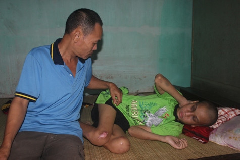 Sau hơn 10 ngày điều trị tại bệnh viện nay các vết thương ngoài của cháu Tú đã đỡ nhưng cháu vẫn còn đau Sau hơn 10 ngày điều trị tại bệnh viện nay các vết thương ngoài của cháu Tú đã đỡ nhưng cháu vẫn còn đau