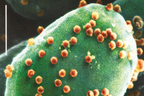 Virut tảo phóng to (Ảnh: Internet) Virut tảo phóng to (Ảnh: Internet)