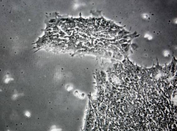 Loại virut được cho có thể khiến con người ngu dốt (Ảnh: Independent) Loại virut được cho có thể khiến con người ngu dốt (Ảnh: Independent)