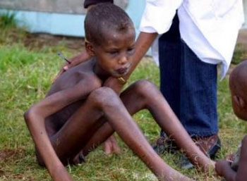 Những nguy cơ của suy dinh dưỡng: - Tăng tỉ lệ tử vong ở trẻ em dưới 5 tuổi : Theo Tổ chức Y tế Thế giới, 54% trường hợp tử vong của trẻ dưới 5 tuổi ở các nước đang phát triển có liên quan đến thiếu dinh dưỡng ở mức độ vừa và nhẹ. Những nguy cơ của suy dinh dưỡng: - Tăng tỉ lệ tử vong ở trẻ em dưới 5 tuổi : Theo Tổ chức Y tế Thế giới, 54% trường hợp tử vong của trẻ dưới 5 tuổi ở các nước đang phát triển có liên quan đến thiếu dinh dưỡng ở mức độ vừa và nhẹ.