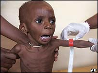 - Tăng các nguy cơ bệnh lý : Nhiễm trùng hô hấp, tiêu chảy… Suy dinh dưỡng là điều kiện thuận lợi để các bệnh lý này xảy ra và kéo dài, bệnh lý làm cho trẻ ăn uống kém, nhu cầu năng lượng gia tăng và vì vậy suy dinh dưỡng ngày càng trở nên nặng nề hơn. - Tăng các nguy cơ bệnh lý : Nhiễm trùng hô hấp, tiêu chảy… Suy dinh dưỡng là điều kiện thuận lợi để các bệnh lý này xảy ra và kéo dài, bệnh lý làm cho trẻ ăn uống kém, nhu cầu năng lượng gia tăng và vì vậy suy dinh dưỡng ngày càng trở nên nặng nề hơn.