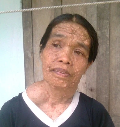 Người đàn bà mang thân hình “quỷ ám” 