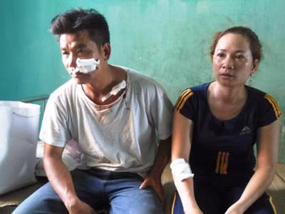 Đang ăn cơm tối, cả gia đình bị côn đồ rượt chém kinh hoàng ảnh 1