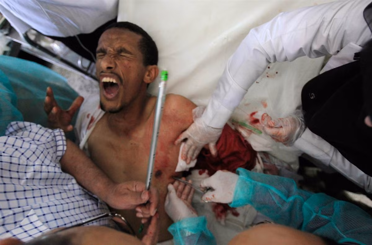 Một người đàn ông tham gia biểu tình và bị bắn trọng thương ở Sanaa, Yemen ngày 23/10/2011. Một người đàn ông tham gia biểu tình và bị bắn trọng thương ở Sanaa, Yemen ngày 23/10/2011.