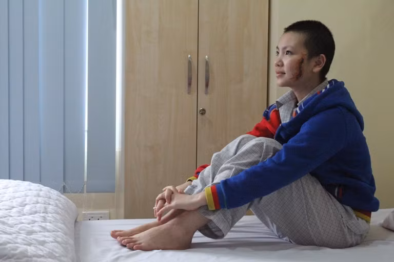 Sau một thời gian điều trị ở Hà Nội thì G đã lạc quan hơn!