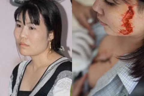 Chân dung bà chủ Trâm Anh (trái) và những vết sẹo đau đớn trên gương mặt G. Chân dung bà chủ Trâm Anh (trái) và những vết sẹo đau đớn trên gương mặt G.