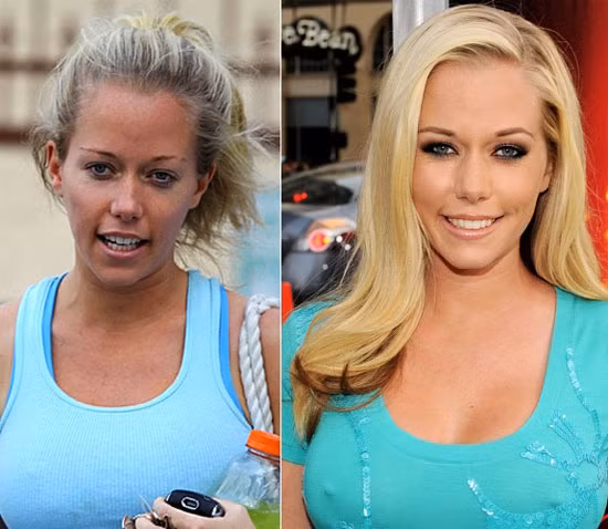 Kendra Wilkinson Xem thêm:Sao xưa và nay: Họ đã “lột xác” ra sao?