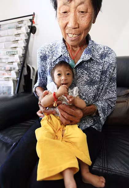 Khi chào đời, Liang nặng vỏn vẹn 1,05kg và cao 33cm. Đã ba năm trôi qua, cô bé chỉ tăng thêm 21cm chiều cao và nặng 2,5kg. Đây quả là con số gây sốc.