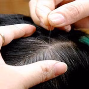 5. Tóc: Các nang tóc trở nên ít hơn và tóc bắt đầu mọc chậm, vì thế đàn ông có xu hướng mỏng tóc trên đỉnh đầu, một số khác thì hói hẳn. 5. Tóc: Các nang tóc trở nên ít hơn và tóc bắt đầu mọc chậm, vì thế đàn ông có xu hướng mỏng tóc trên đỉnh đầu, một số khác thì hói hẳn.
