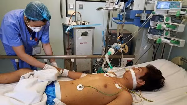 Chuyện gì xảy ra nếu bạn mắc Viêm gan C? ảnh 1