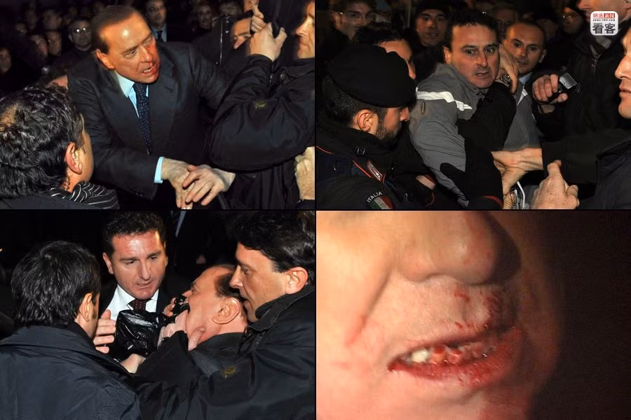 Ngày 13/12/2009, Thủ tướng Ý Silvio Berlusconi vừa bước ra khỏi cuộc họp chính đảng thì bị một người đàn ông cầm dị vật đánh thẳng vào mặt khiến Thủ tướng Ý rơi 2 răng giả, dập xương mũi Ngày 13/12/2009, Thủ tướng Ý Silvio Berlusconi vừa bước ra khỏi cuộc họp chính đảng thì bị một người đàn ông cầm dị vật đánh thẳng vào mặt khiến Thủ tướng Ý rơi 2 răng giả, dập xương mũi