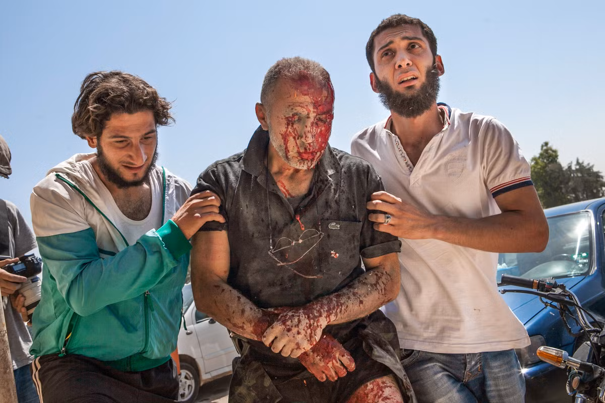 Người đàn ông bị thương nặng tại Saraqeb, tây bắc Syria sau khi một quả bom do máy bay trực thăng của Không quân thả xuống phát cách chiếc xe của ông 10 mét hôm 20/7.