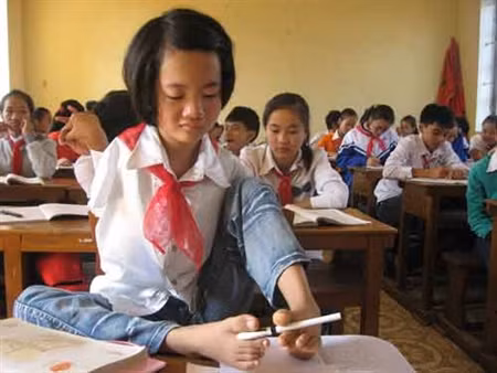 Nhưng rồi, việc tập luyện và những nỗi vất vả trong cuộc sống, cùng với di chứng của chất độc dioxin đã khiến em bị vẹo cột sống. Đôi chân thần kỳ của em giờ cũng bên ngắn, bên dài. Bàn chân trái cầm bút viết đã dài hơn bàn chân phải. 15 tuổi, nhưng em chỉ cao chưa đầy 1,4m và nặng chỉ 26kg. >>Vẻ đẹp mặn mà của hotgirl Midu >>Những gương mặt cực hot tại Miss Việt Đức >>Những nữ sinh tỏa sáng tại Hoa hậu Phụ nữ Việt Nam qua ảnh >>So độ siêu kute của những nữ sinh đình đám nhất Thủ đô >>Phát sốt vì 4 nữ giáo viên xinh đẹp >>Hoa khôi ĐH Thương Mại 2012 duyên dáng áo dài >>Những hotgirl xinh đẹp làm điên đảo cư dân mạng Những nữ sinh đẹp mê hồn giữa đầm sen Nhưng rồi, việc tập luyện và những nỗi vất vả trong cuộc sống, cùng với di chứng của chất độc dioxin đã khiến em bị vẹo cột sống. Đôi chân thần kỳ của em giờ cũng bên ngắn, bên dài. Bàn chân trái cầm bút viết đã dài hơn bàn chân phải. 15 tuổi, nhưng em chỉ cao chưa đầy 1,4m và nặng chỉ 26kg. >>Vẻ đẹp mặn mà của hotgirl Midu >>Những gương mặt cực hot tại Miss Việt Đức >>Những nữ sinh tỏa sáng tại Hoa hậu Phụ nữ Việt Nam qua ảnh >>So độ siêu kute của những nữ sinh đình đám nhất Thủ đô >>Phát sốt vì 4 nữ giáo viên xinh đẹp >>Hoa khôi ĐH Thương Mại 2012 duyên dáng áo dài >>Những hotgirl xinh đẹp làm điên đảo cư dân mạng Những nữ sinh đẹp mê hồn giữa đầm sen