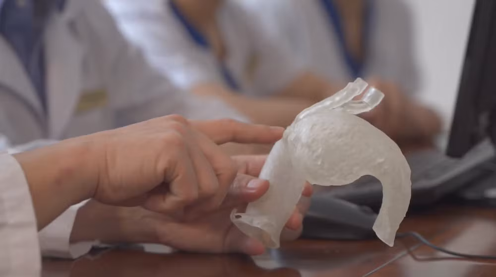 Mô hình quả tim in 3D với kích thước và tổn thương động mạch giống hoàn toàn thực tế Mô hình quả tim in 3D với kích thước và tổn thương động mạch giống hoàn toàn thực tế