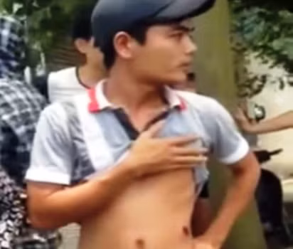 Vết thương trên cơ thể anh Nghĩa do đạn cao su gây nên (ảnh: internet) Vết thương trên cơ thể anh Nghĩa do đạn cao su gây nên (ảnh: internet)