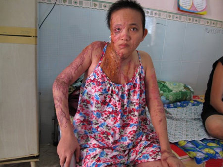 Chị Phạm Thị Thanh Xuân phải gánh hậu quả của kẻ "tâm thần hoang tưởng".